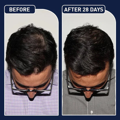 Feg Hair Growth Serum
