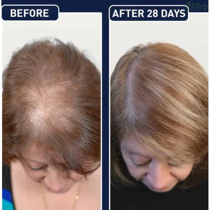 Feg Hair Growth Serum