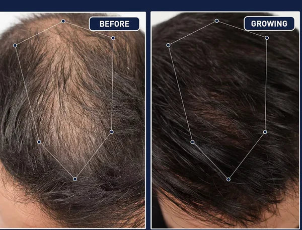 Feg Hair Growth Serum