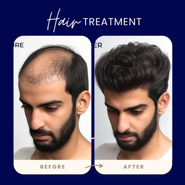 Feg Hair Growth Serum